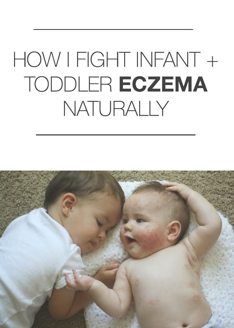 How I Fight Infant + Toddler Eczema Naturally 